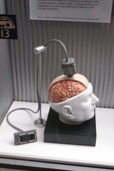 Interfaz cerebro-ordenador BrainGate Modelo de una interfaz cerebral BrainGate conectada a un sensor