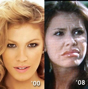 Comparación del rostro de Nikki Cox en 2000 y 2008